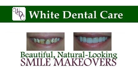 general dentistry white dental care woodward ok smile gallery makeovers